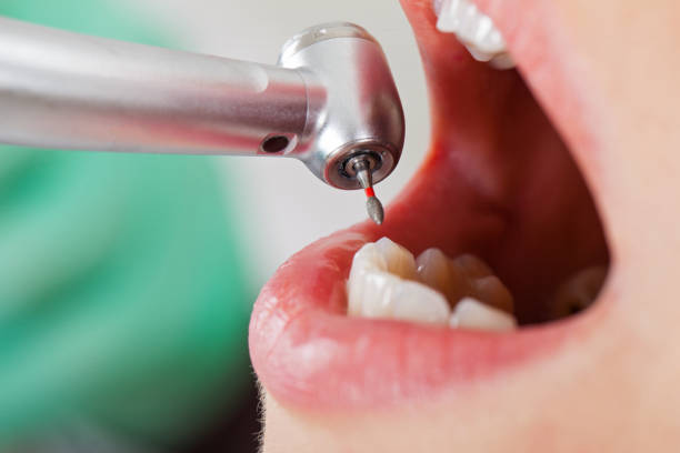Best Cracked Tooth Emergency Dentist  in St Peter, WI